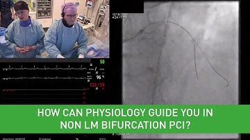 How can physiology guide you in non LM bifurcation PCI? - PCR Webinar