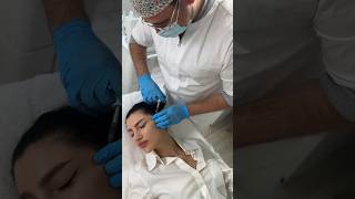 Как мне делали скулы! #luxmedicus #drmikhailkordas #beauty #clinic #инъекции #гиалуронка #juvederm