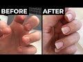 Exactly How I Stopped Biting My Nails