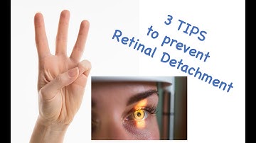 3 tips to prevent retinal detachment/ #retinaldetachment