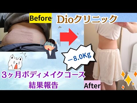 Dioクリニック～3ヶ月ボディメイクコース結果報告～ - YouTube