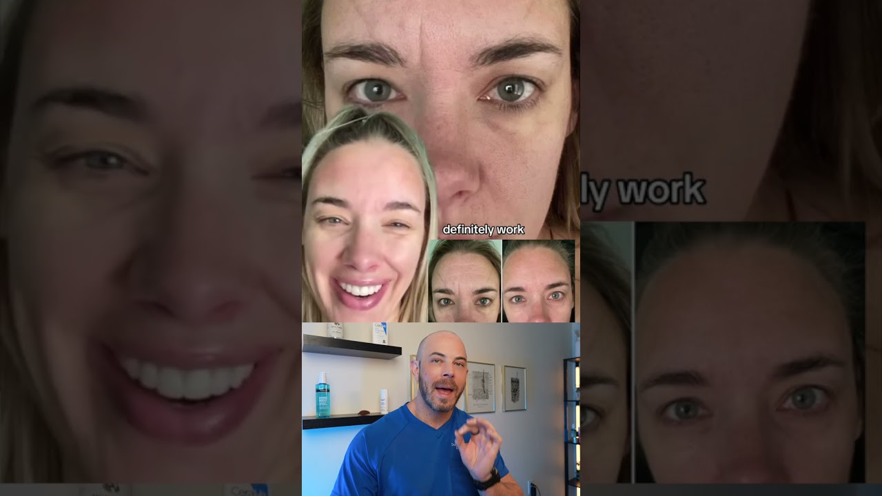 Derm reacts to viral Frownies for forehead wrinkles! 