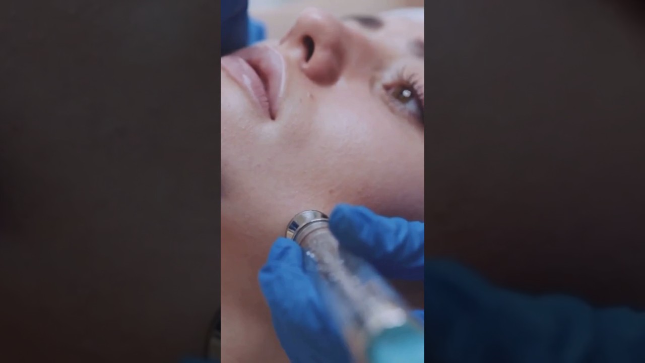 Say Goodbye to Stretch Marks! 