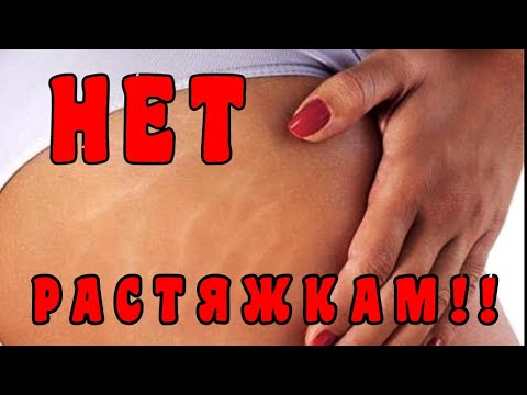 Вопрос: Как избавиться от растяжек натуральными способами?