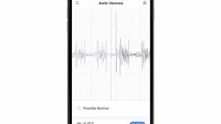 Aortic Stenosis Phonocardiogram - EkoCLINIC App screenshot 2