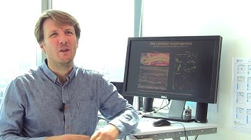 Shaping Lumen Morphology