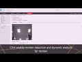 Setting Up Motion Detection and Recording