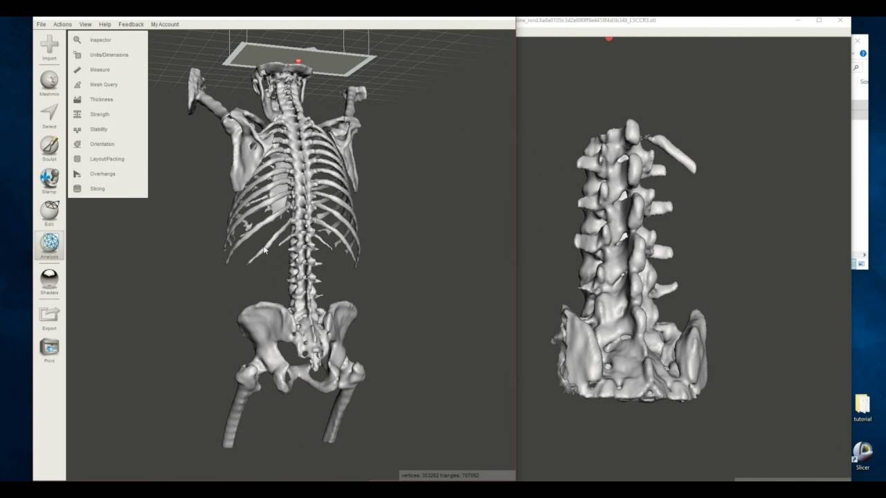 Advanced Free 3d Printable Bone Creation Creating And Processing Multiple Models From A Ct Scan Youtube
