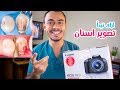 تشترى كاميره ايه و معدات تصوير تبدأ بيها تصوير الاسنان | Dental Photography