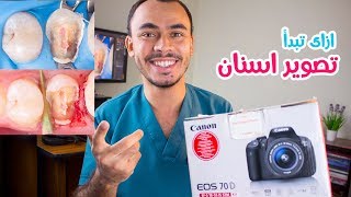 تشترى كاميره ايه و معدات تصوير تبدأ بيها تصوير الاسنان | Dental Photography screenshot 3