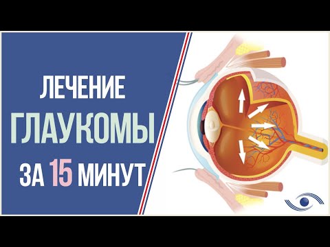 Лечение Глаукомы в Новосибирске  ОПЕРАЦИИ ПРИ ГЛАУКОМЕ  Клиника Лантуха