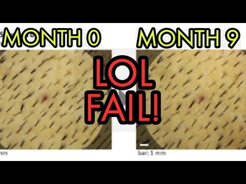 **huge**-shiseido/replicel-rch-01-treatment-update-and-i'm-so-disappointed!