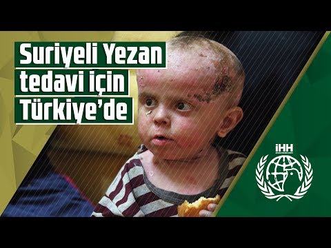 Suriyeli Yezan tedavi için Türkiye’de