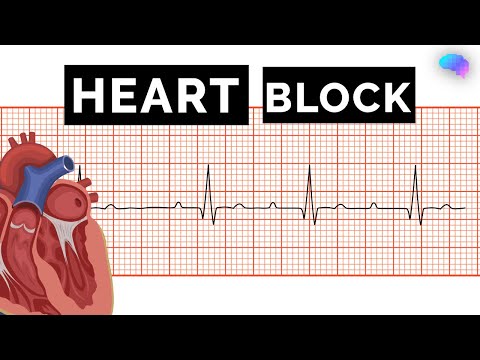 Heart Block |