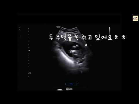 콩콩 태교일기, 임신 15주 6일(16주)