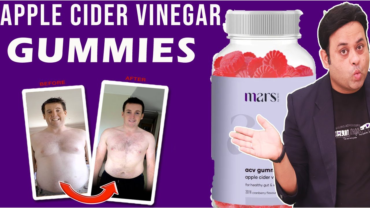 Apple cider vinegar gummies by mars II Honest Review