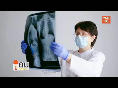 มะเร็งปอด (Lung cancer) สาเหตุการเสียชีวิตอันดับต้น ๆ ของคนไทยและทั่วโลก มะเร็งที่พบได้บ่อยในผู้ชาย