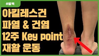 아킬레스건통증. 아킬레스건염. 12주 재활 전략 (실제 파열 재활 케이스)