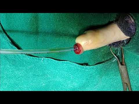 Video: Urethral Shaft Abnormality Sa Mga Aso