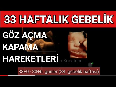 Video: 33 Haftalık Hamilelik: Duyular, Fetal Gelişim, Ultrason