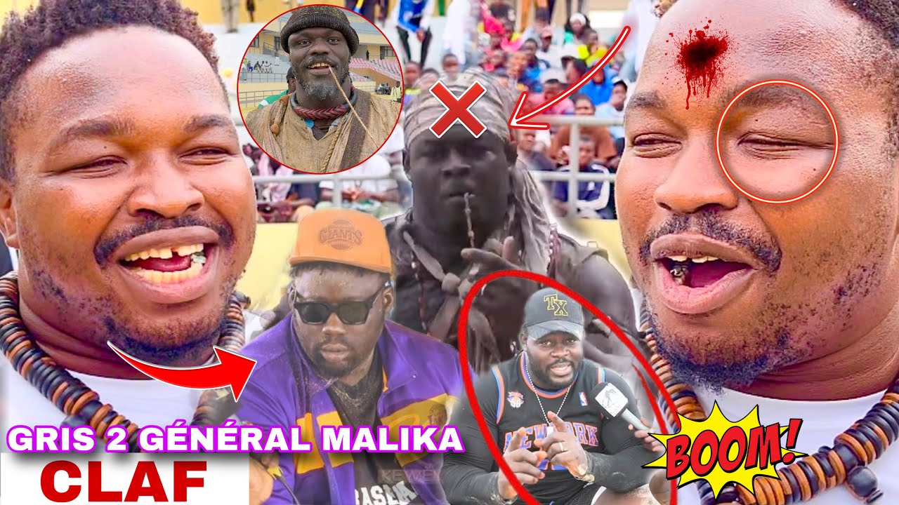 Doudou Sané attaque Général Malika gravement‼️Gris 2 ragal la na dieul sama avance..