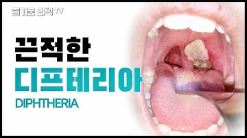 디프테리아 Diphtheria