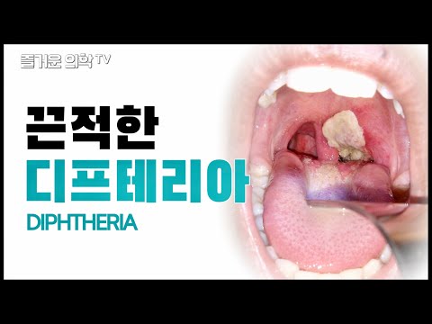 디프테리아는 무서운 1급 감염병입니다! Diphtheria [feat. 발토]