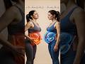 Pregnant Woman: Sleeping Healing vs No Sleep Damage #ytshorts#shorts#short#viral#viralshorts#baby