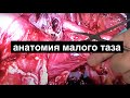 если хочешь узнать анатомию таза, смотри эту операцию//операция Вертгейма // Shailesh Puntambekar