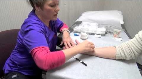 Allergy Scratch Testing