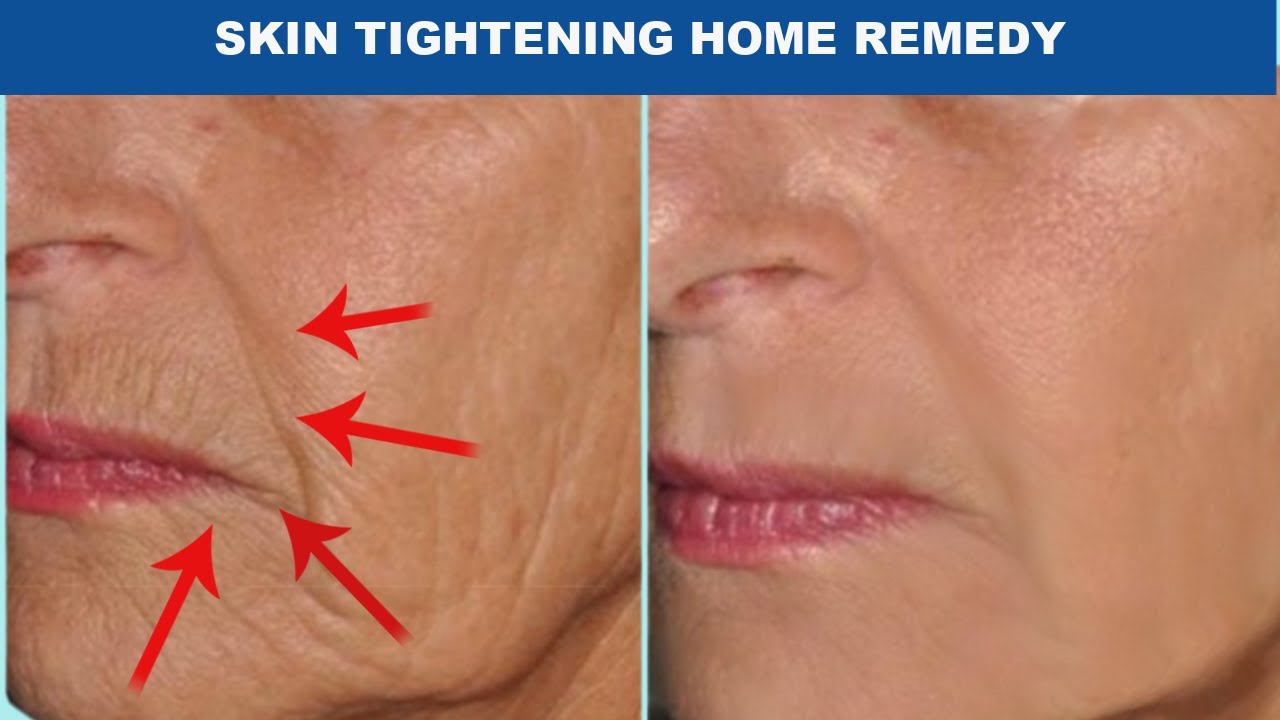 JUST 1 ANTI AGING SKIN TIGHTENING & LIFTING HOME REMEDY FOR FIRMER ...