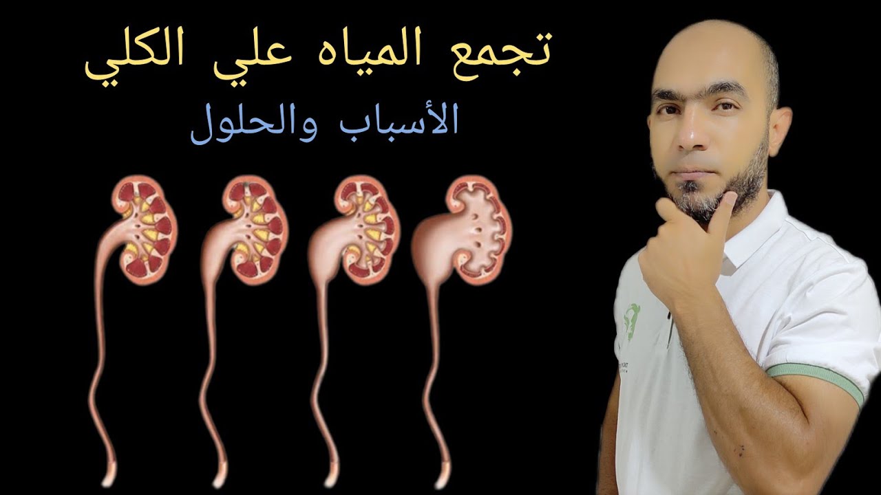 تجمع المياه علي الكلي | تعرف علي الأسباب |  إهمالها خطير @Dr_youssef#الكلى