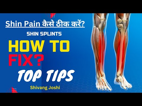 Shin Splints: Causes, Symptoms & Treatment