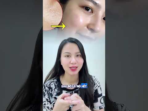 Combo p.eel sử dụng như thế nào ? #nguyenmaihuong #chamsocda