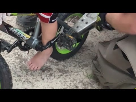 Rescue Worker Uses Jaws of Life to Free Child from Bike Frame || WooGlobe