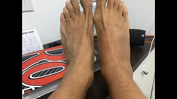 Como tratar uma entorse no tornozelo rapidamente?