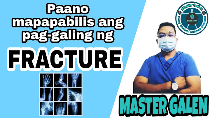 FRACTURE, PAANO MAPAPABILIS ANG PAG GALING