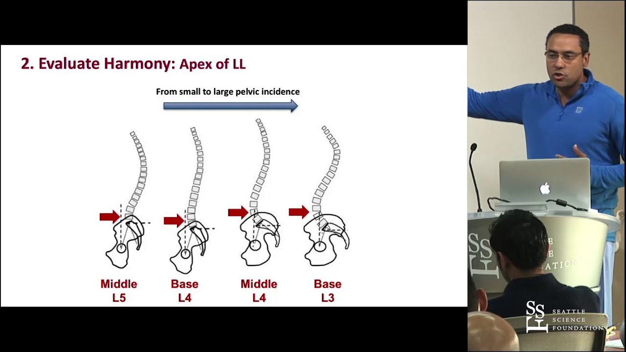 Sagittal Balance and Parameters - David O. Okonkwo, MD, PhD