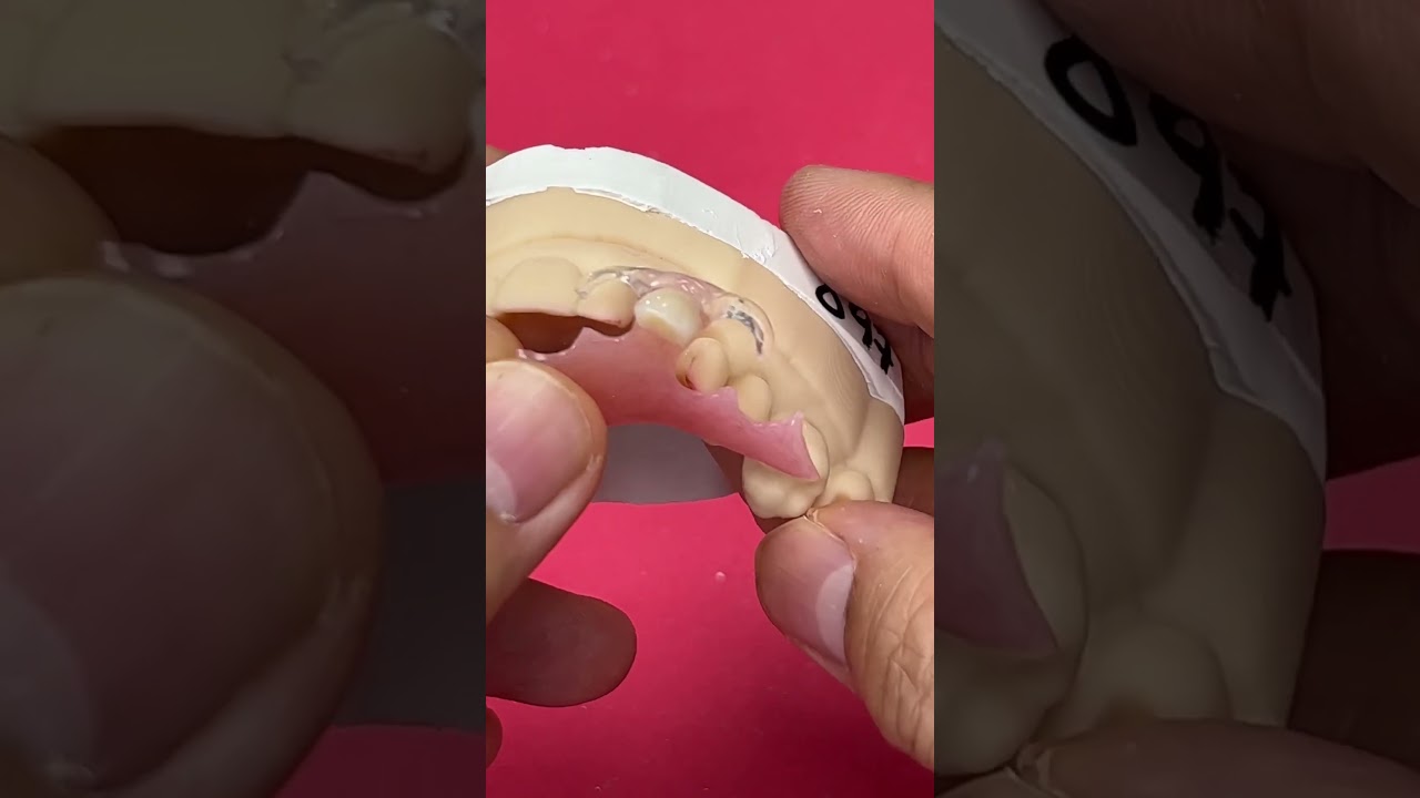 Acrylic Partial with Clear Clasps 