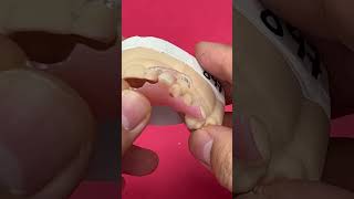 Acrylic Partial with Clear Clasps @EnvisiontecMain #envisiontec #dentist #short #shorts #shortvideo