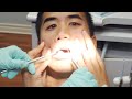 Can't Feel My Face - played with dentist equipment. | Andrew Huang