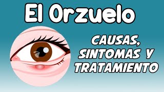 EL ORZUELO, Causas, síntomas, diagnóstico y tratamiento