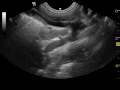 ultrasonography of spleno-azygous portosystemic shunt in a dog part II