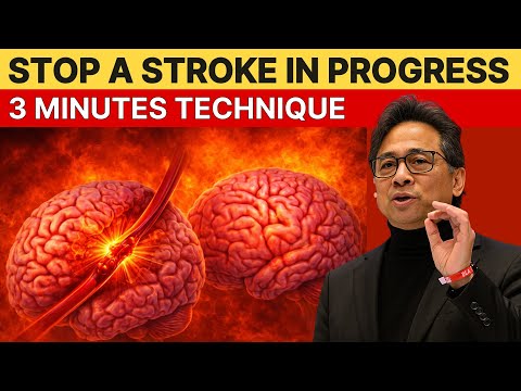 3 Minute Stroke Stopping Technique For Seniors Dr William Li 