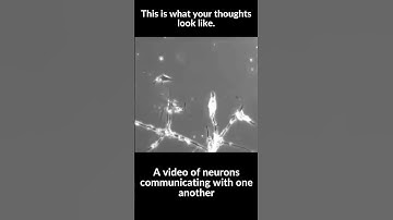 Your thoughts appear like this. #shorts