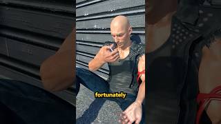 Celebrity A Needle Snapped On His Vein 😨 Surgeon Reacts Profile