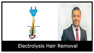 ازالة الشعر بتقنية التحليل الكهربائي - Electrolysis hair removal