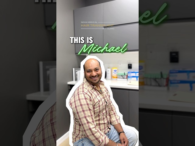 Your Sign to Do Something About Your Hairline 🚀 / #hairsurgery #novahairtransplant