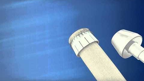 ByFix devise of HDH Medical, video produced by Virtual Point