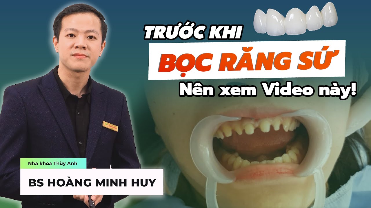 Outline Video Bọc Răng Sứ Thẩm Mỹ Thế Nào Là Đẹp?